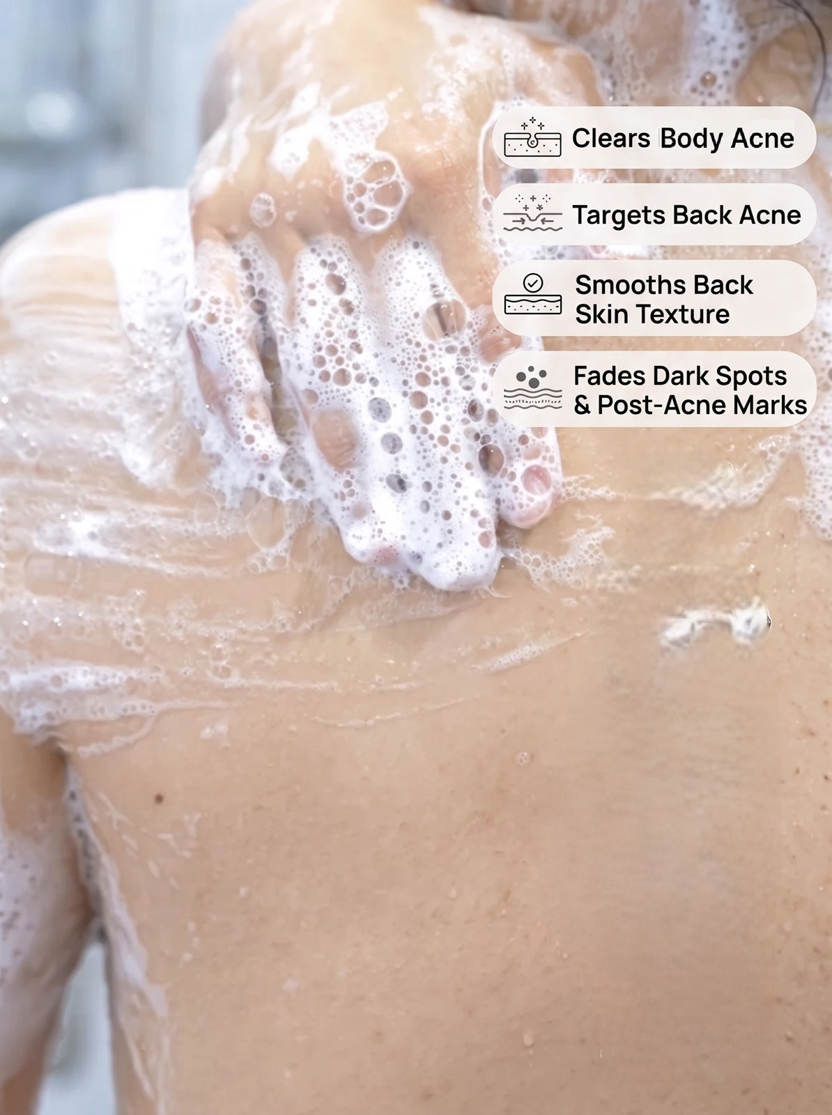 7% AHA BHA Body Wash for Body &amp; Back Acne – Glycolic, Salicylic Acid &amp; Niacinamide | 250ml