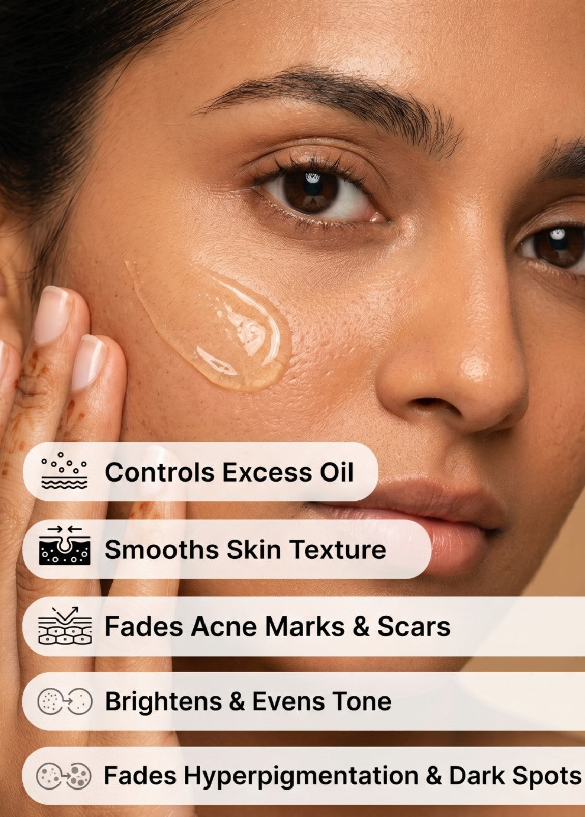 10% Niacinamide + Zinc Face Serum – Oil Control &amp; Acne Marks Solution